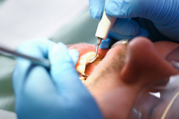 Best Dentist for Dental Trauma  in USA